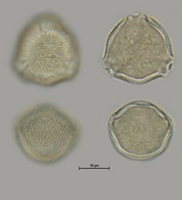 Pollen der Erdbeere (Vergrößert das Bild in einem Dialog Fenster)