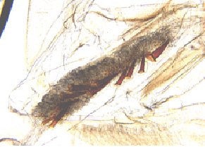 © AGES/Kahrer Mikroskopische Aufnahme des männlichen Genitales des Baumwollkapselwurms