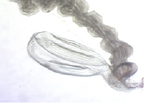 Mikroskopische Aufnahme des weiblichen Genitals des Baumwollkapselwurms