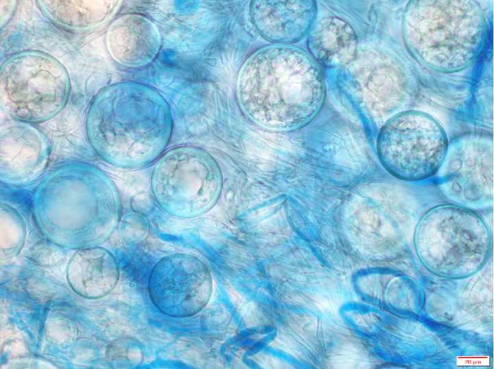 © AGES/Plenk Mikroskopische Aufnahme der Chlamydosporen von Phytophthora ramorum