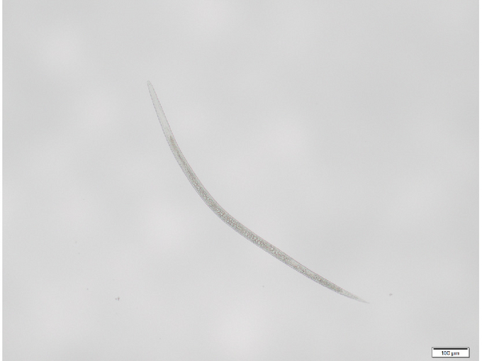 © AGES/Gabl Mikroskopische Aufnahme einer Larve des Stängelälchens