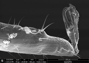 Last leg segment of the anteriormost tick leg with the sensory pit in the center of the image (Enlarges Image in Dialog Window)