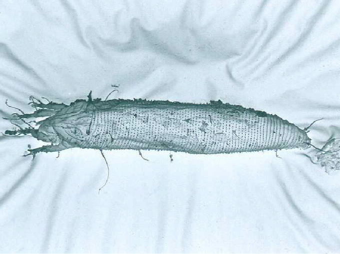 © AGES/Richter Großaufnahme einer Knoblauchgallmilbe zur Erkennung der zwei Beinpaare und des walzenförmigen Körpers