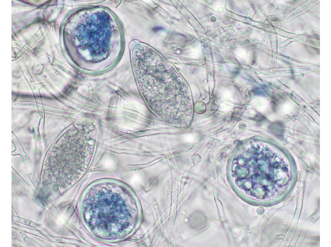 Mikroskopische Aufnahme der Sporangien von Phytophtora ramorum
