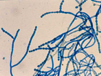 © AGES Mikroskopische Aufnahme von Konidien. Lange Ketten einzelner Sporen