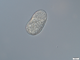 mikroskopische Aufnahme eines Eies des Wurzelgallenälchens